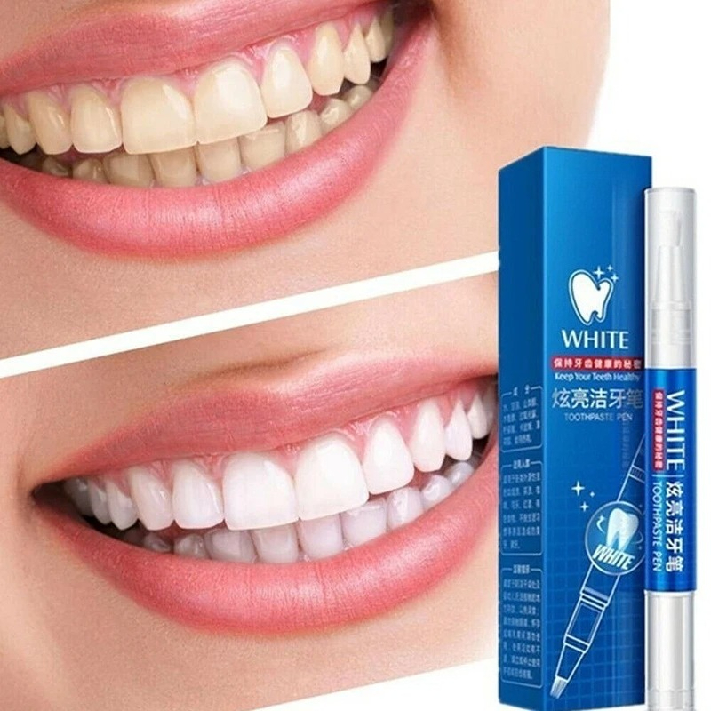 50 ML Teeth Whitening Stain Re - Teeth Whitening Gel Pen recensie en prijs