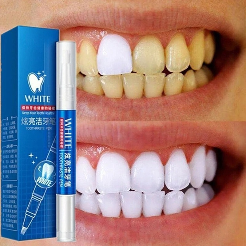 50 ML Teeth Whitening Stain Re - Teeth Whitening Gel Pen recensie en prijs