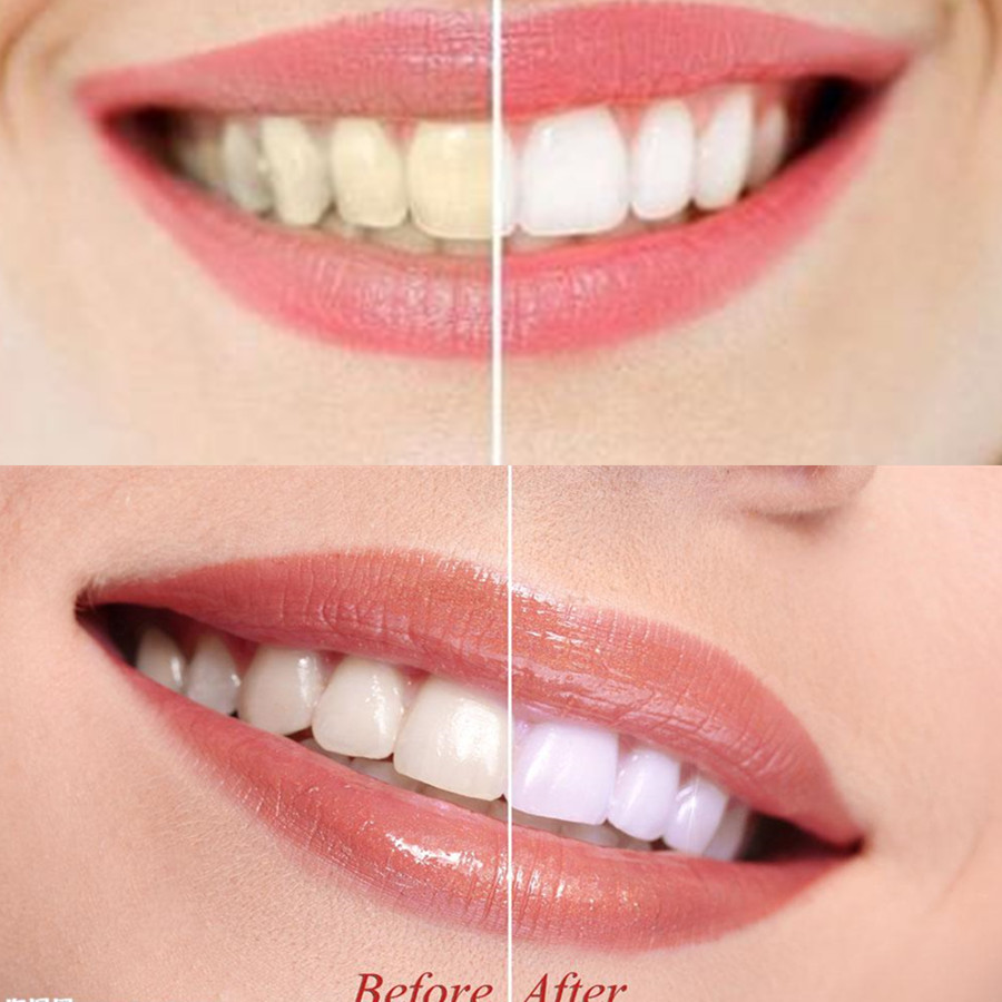 Bamboo Charcoal Teeth Tooth De - Teeth Whitening From Home recensie en prijs