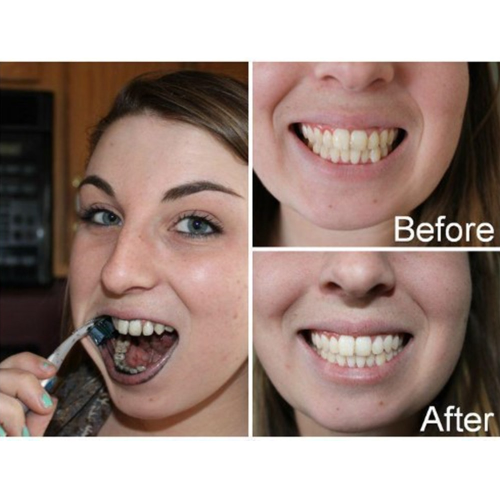 Bamboo Charcoal Teeth Tooth De - Teeth Whitening From Home recensie en prijs