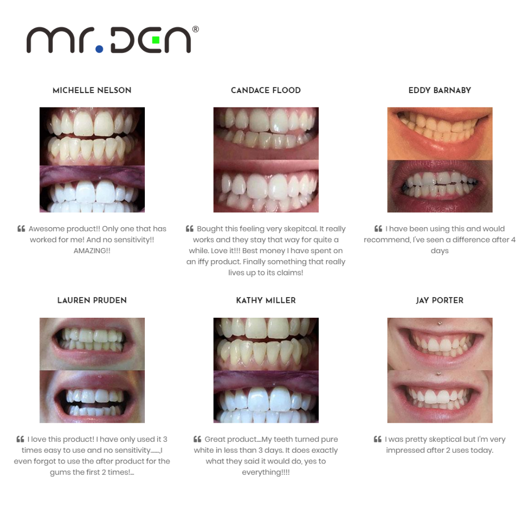 Dr. Whiten 3 Pack Teeth Whiten - Teeth Whitening Kit Professional recensie en prijs