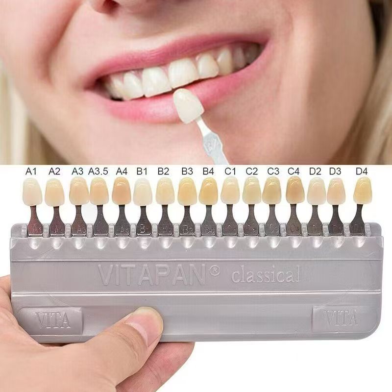 VITA 16 Colors Teeth Shade Gui - Teeth Whitening Kit Professional recensie en prijs