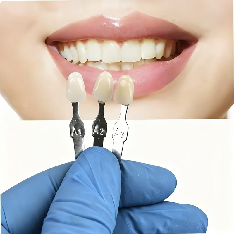 VITA 16 Colors Teeth Shade Gui - Teeth Whitening Kit Professional recensie en prijs