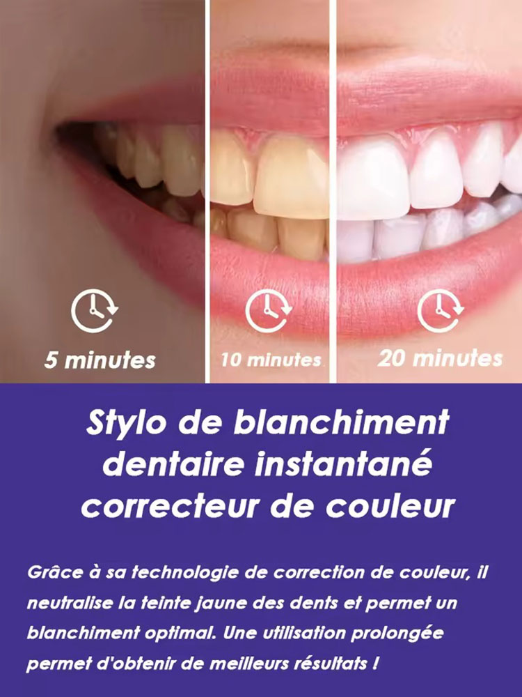 8ml*2 Teeth Whitening Pen Set  - Teeth Whitening Gel Pen recensie en prijs