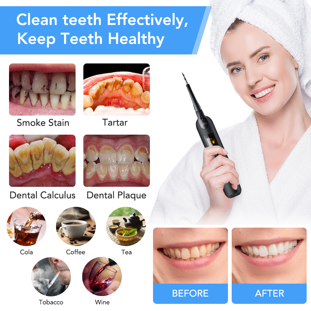 Teeth Tartar Remover Electric  - Teeth Whitening At Home Kit recensie en prijs