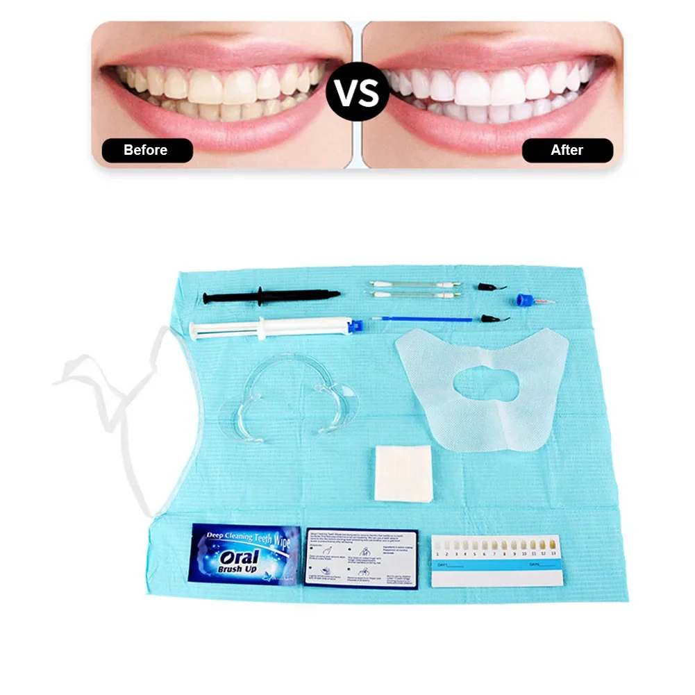 Dentist Clinic Teeth Whitening - Teeth Whitening Gels Used By Dentists recensie en prijs