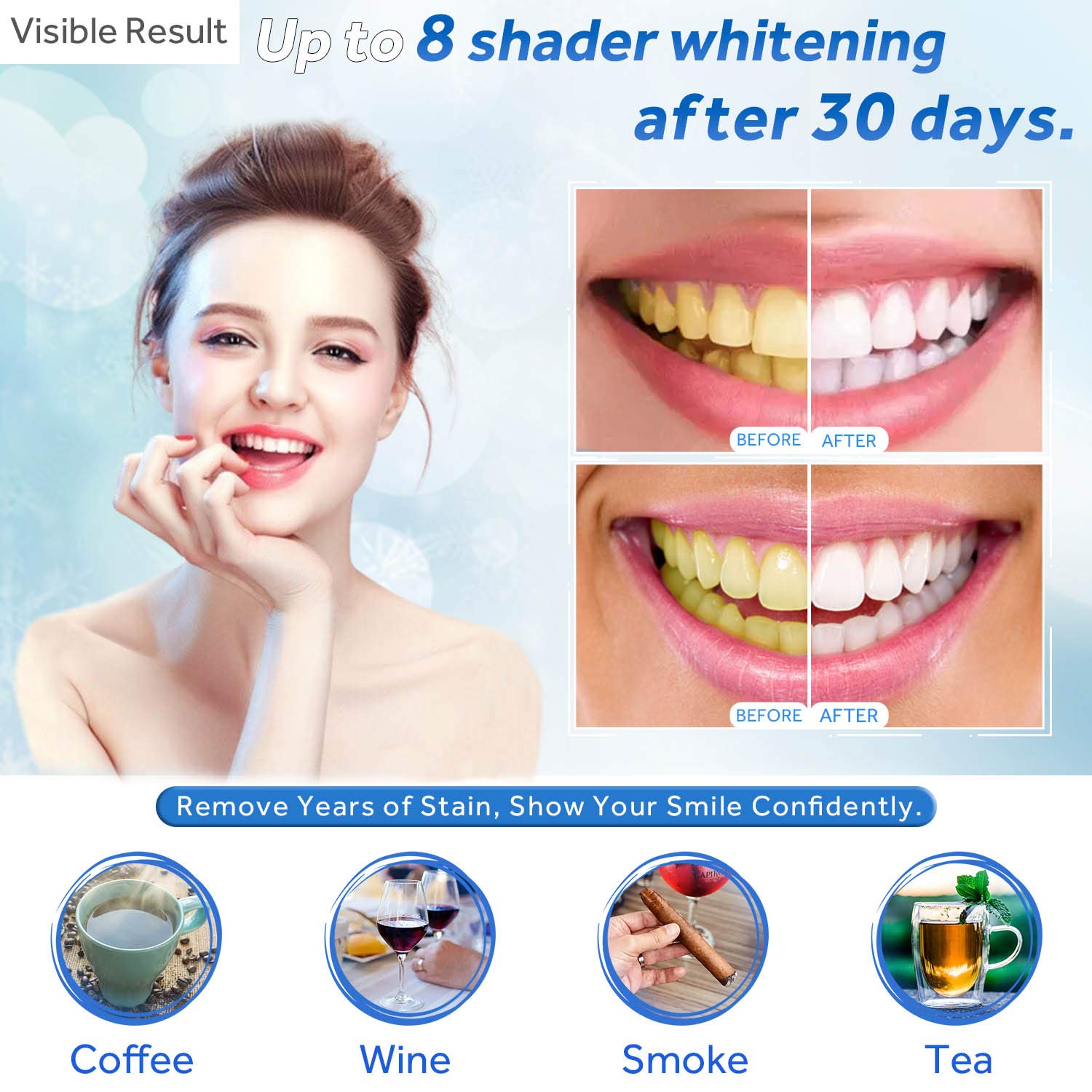 Teeth Whitening Gel Refill Syr - Teeth Whitening Gel Pen recensie en prijs