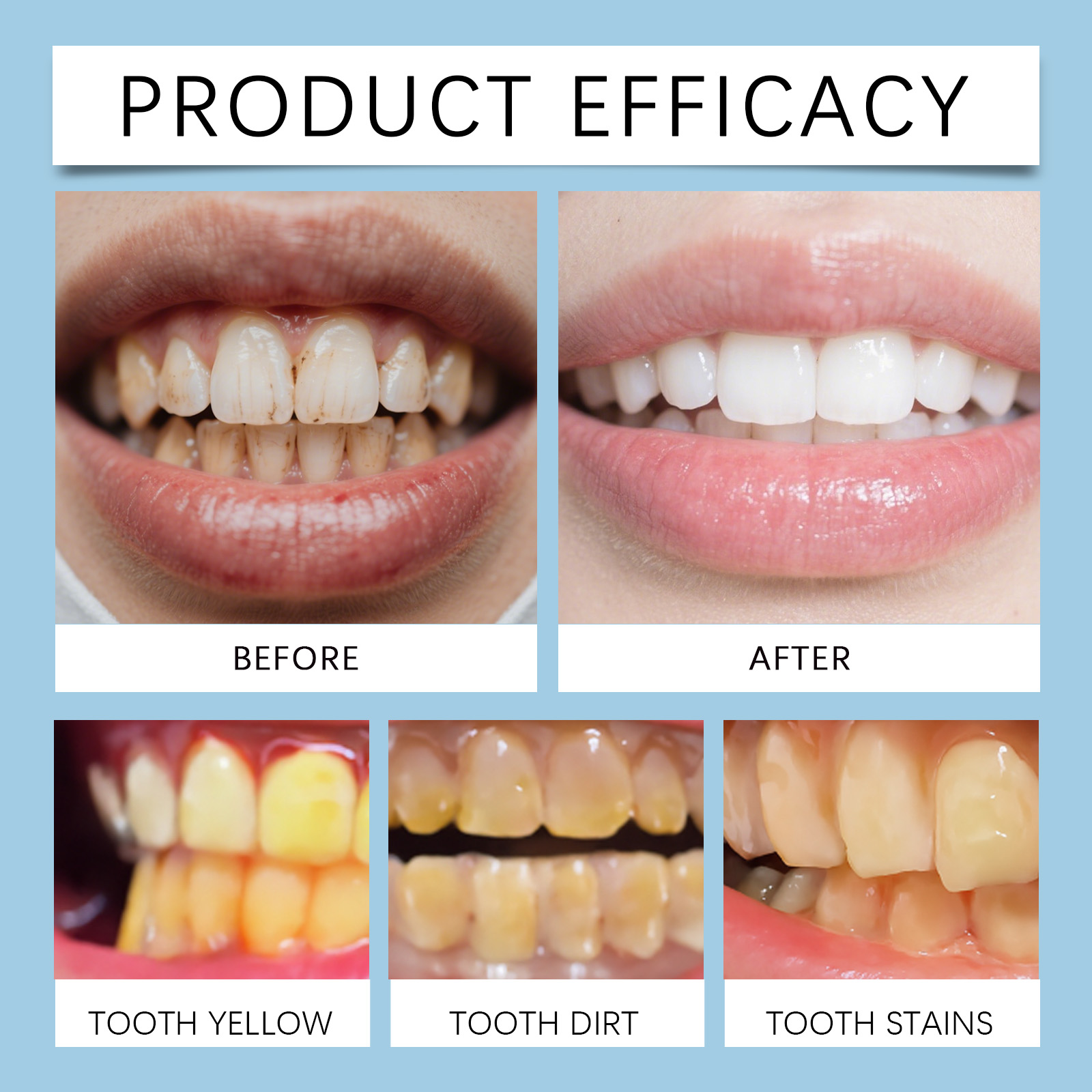 Feimuko 8ml Teeth Gel Pen Gent - Teeth Whitening Gel Pen recensie en prijs