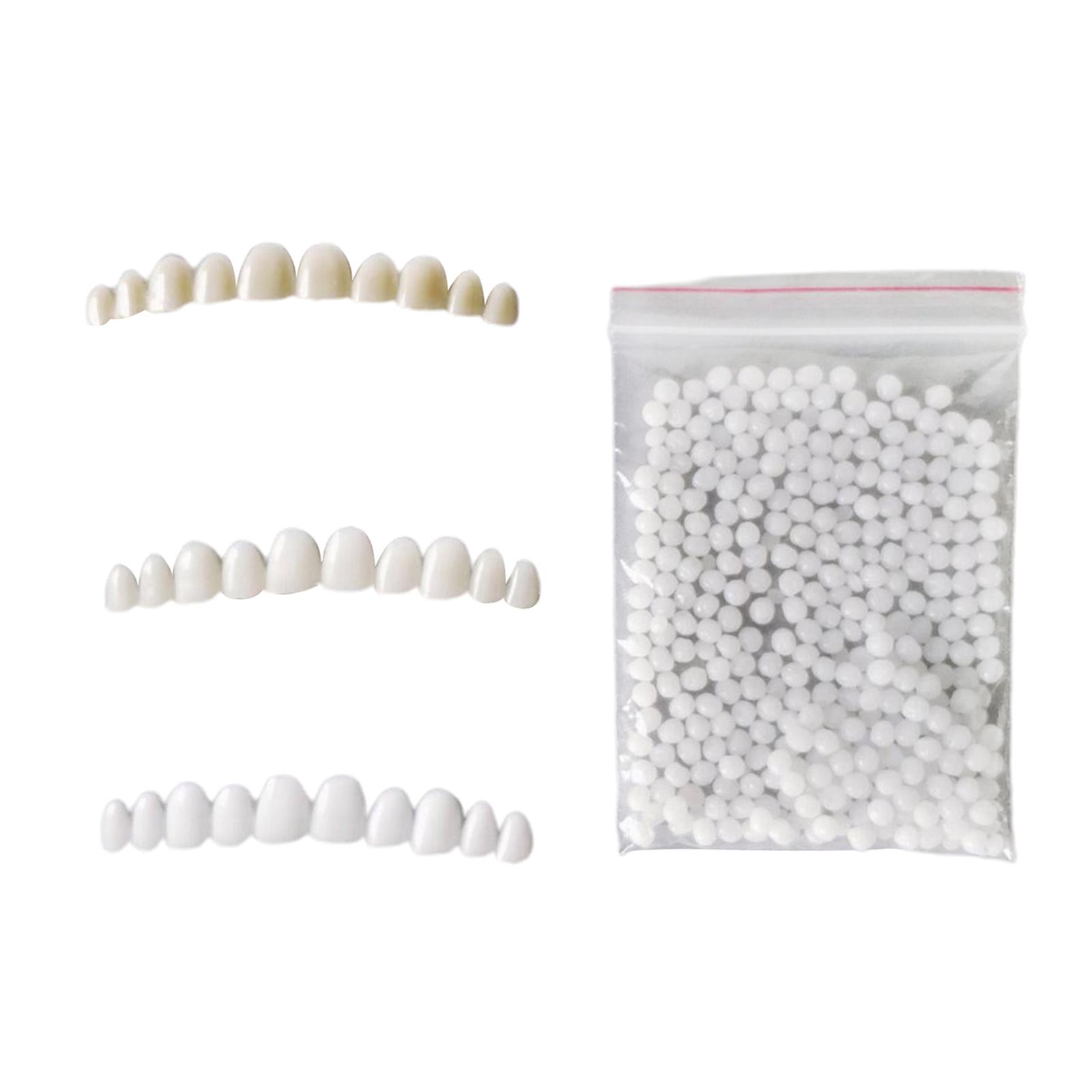 Temporary Teeth Whitening Kit  - Teeth Whitening At Home Kit recensie en prijs