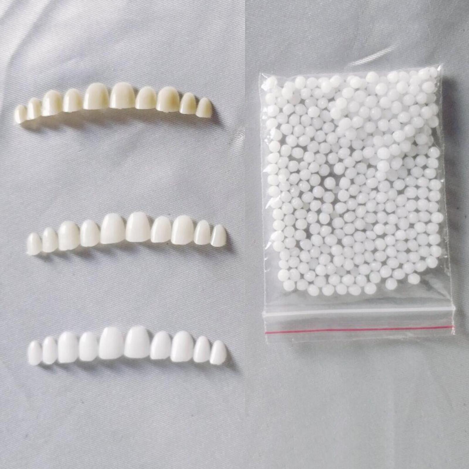 Temporary Teeth Whitening Kit  - Teeth Whitening At Home Kit recensie en prijs