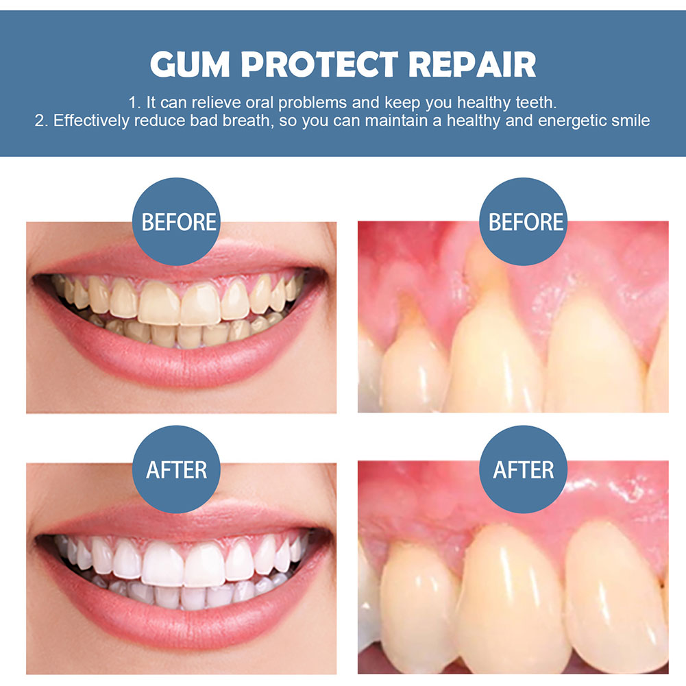 Gum Protection Repair Gel Reli - Teeth Whitening Gel Pen recensie en prijs