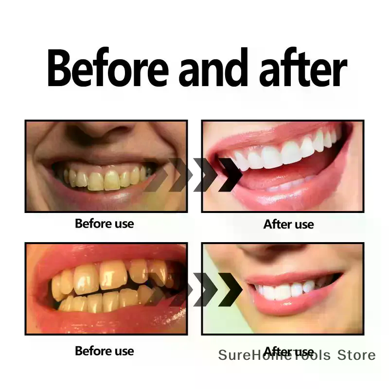 Bamboo Charcoal Powder For Tee - Teeth Whitening App recensie en prijs