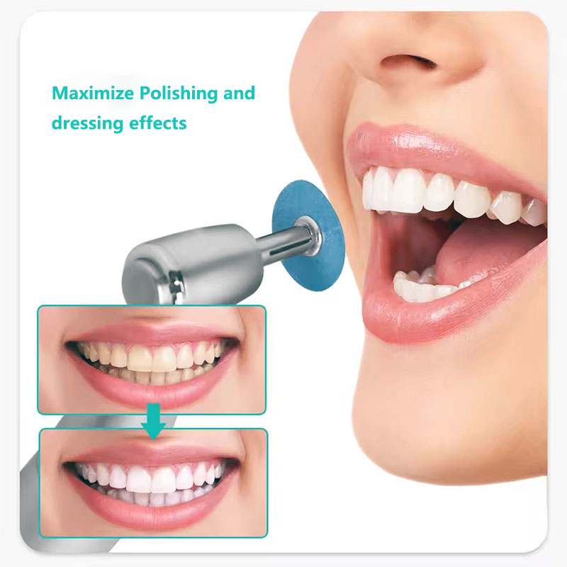 40pcs Dental Polishing Discs H - Teeth Whitening Kit Professional recensie en prijs