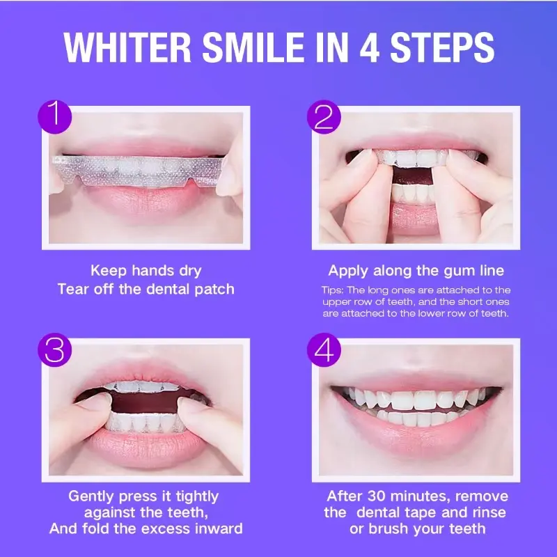 Teeth Whitening Kit - 5X LED L - Teeth Whitening From Home recensie en prijs