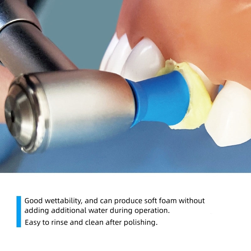 40g/Tube Dental Tooth Polishin - Teeth Whitening Kit Professional recensie en prijs