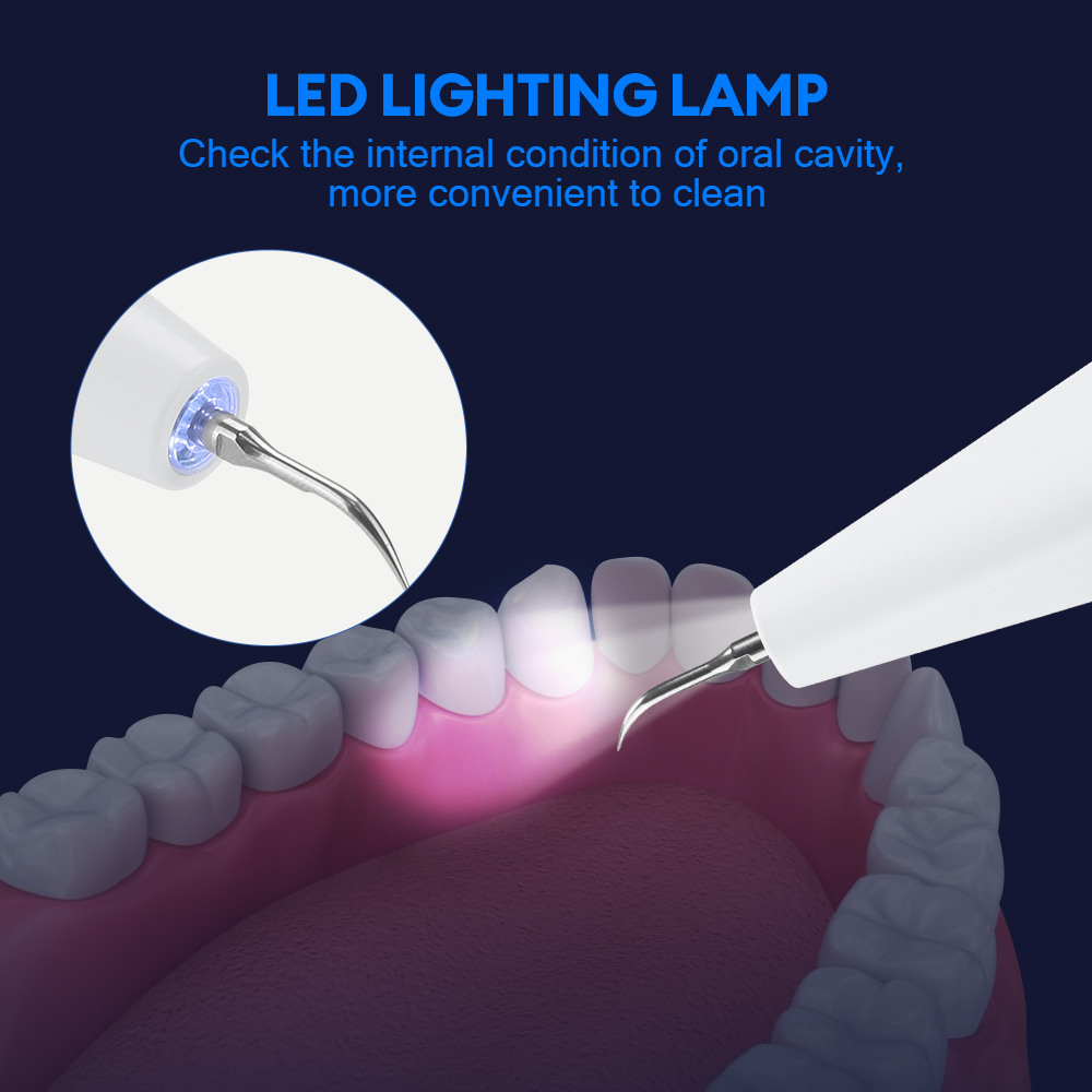 Ultrasonic Dental Calculus Rem - Teeth Whitening Kit Professional recensie en prijs