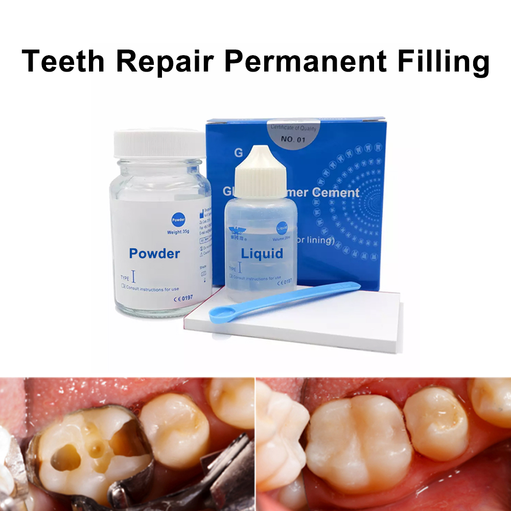 Permanent Teeth Filling Repair - Teeth Whitening At Home Kit recensie en prijs