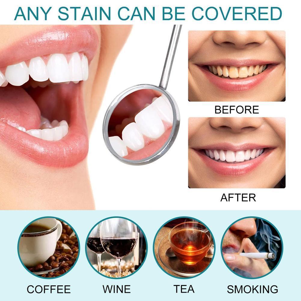 Teeth White Paint Anti Pigment - Teeth Whitening Gel Pen recensie en prijs