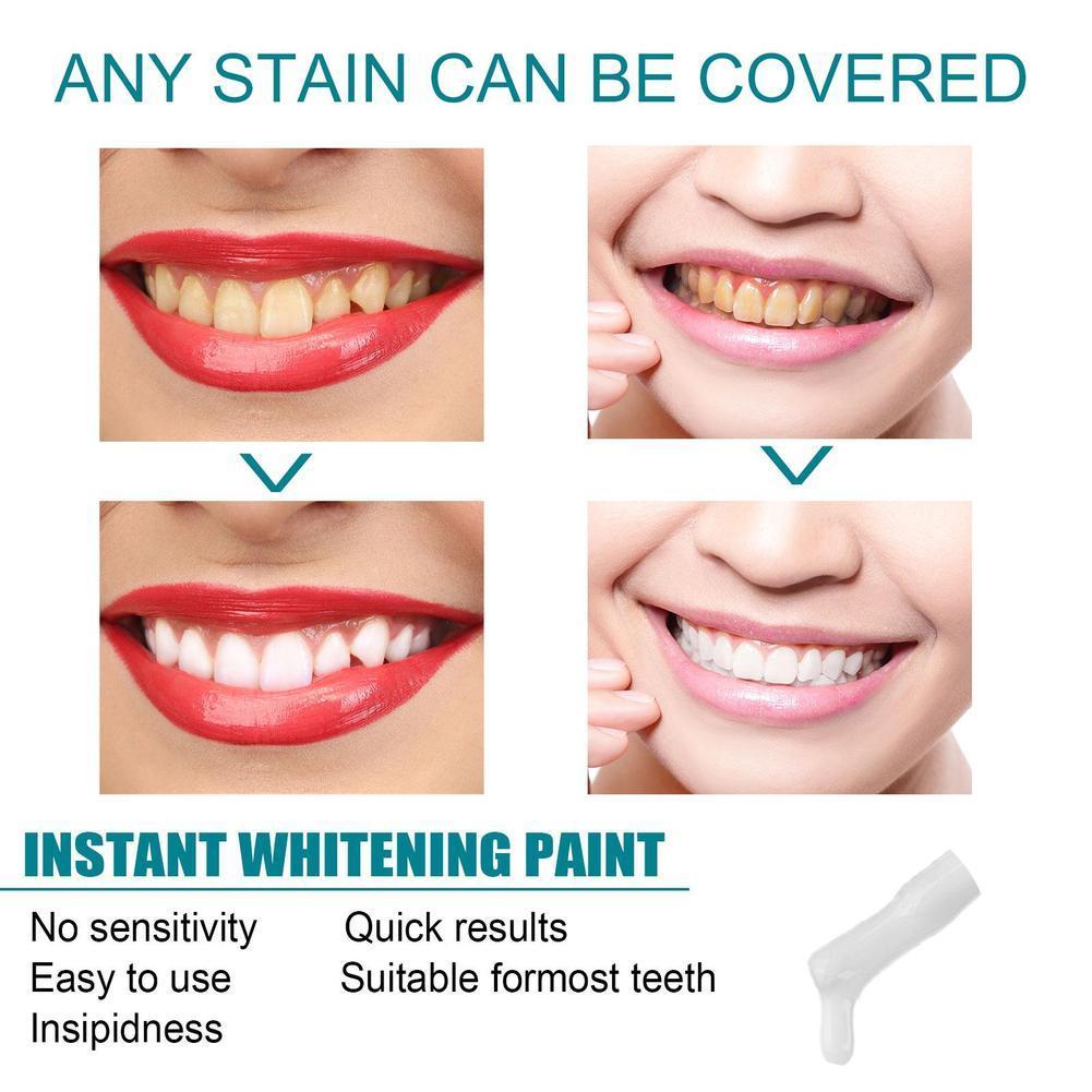 Teeth White Paint Anti Pigment - Teeth Whitening Gel Pen recensie en prijs