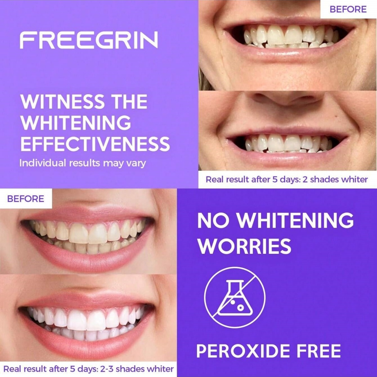 Deluxe Whitening Teeth Sticker - Teeth Whitening From Home recensie en prijs
