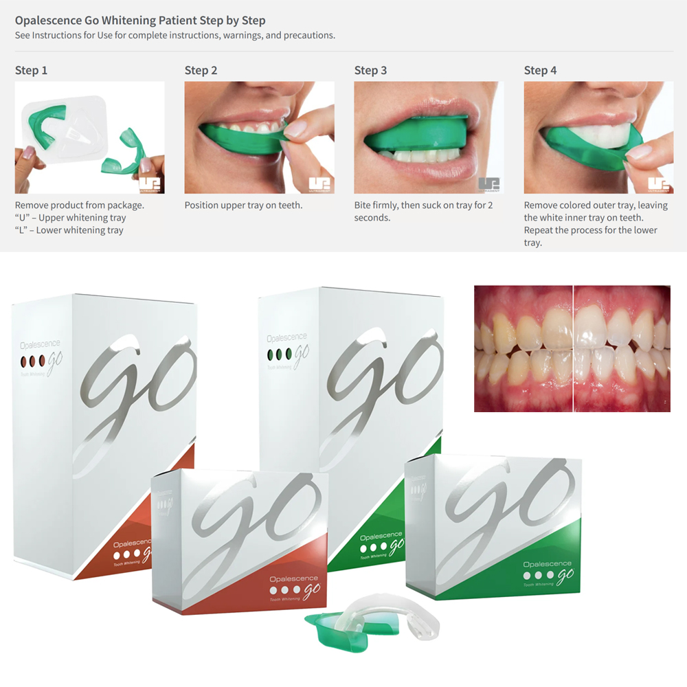 Opalescence Go Teeth Whitening - Teeth Whitening At Home Kit recensie en prijs