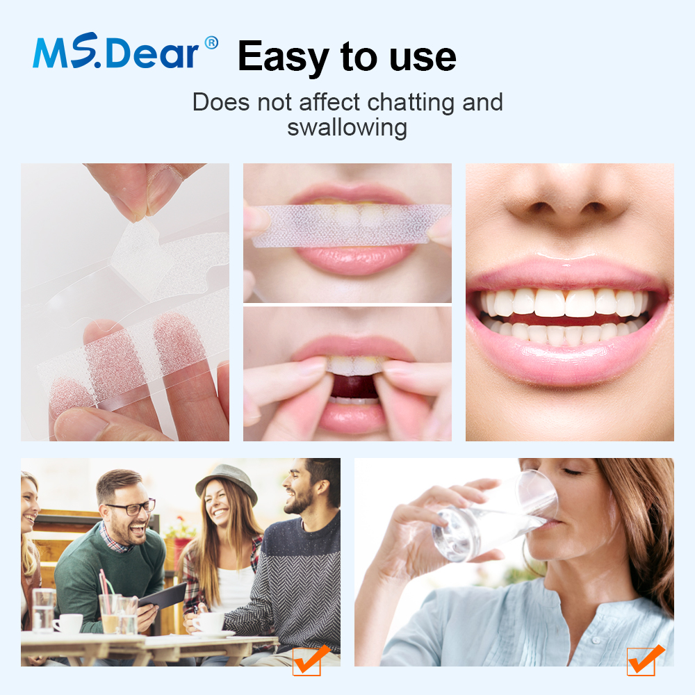Teeth Whitening Strips Cleansi - Teeth Whitening From Home recensie en prijs